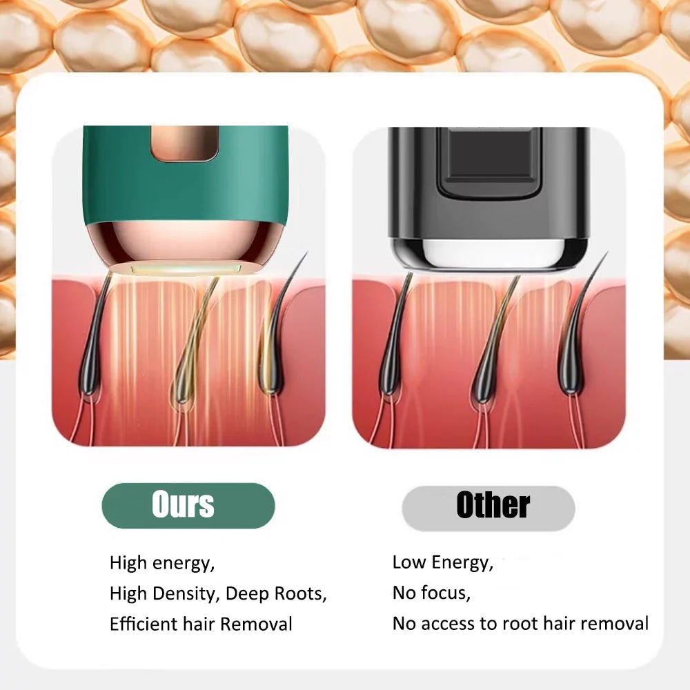 Upgraded 990,000 Flashes Hair Removal Device for Women'S and Men'S Facial & Legs with Cooling System, Green