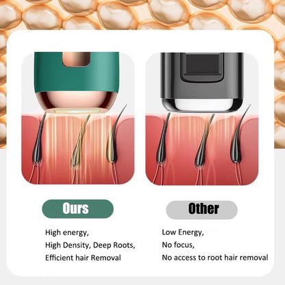 Upgraded 990,000 Flashes Hair Removal Device for Women'S and Men'S Facial & Legs with Cooling System, Green